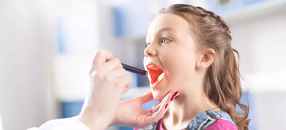 Amigdalitis: cómo identificar cuándo se debe realizar una cirugía