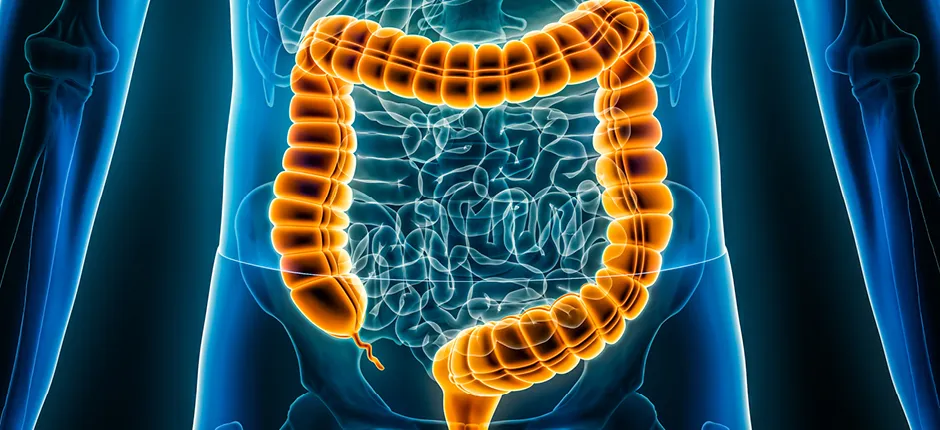 Cáncer colorrectal: exámenes de rutina para detectarlo a tiempo