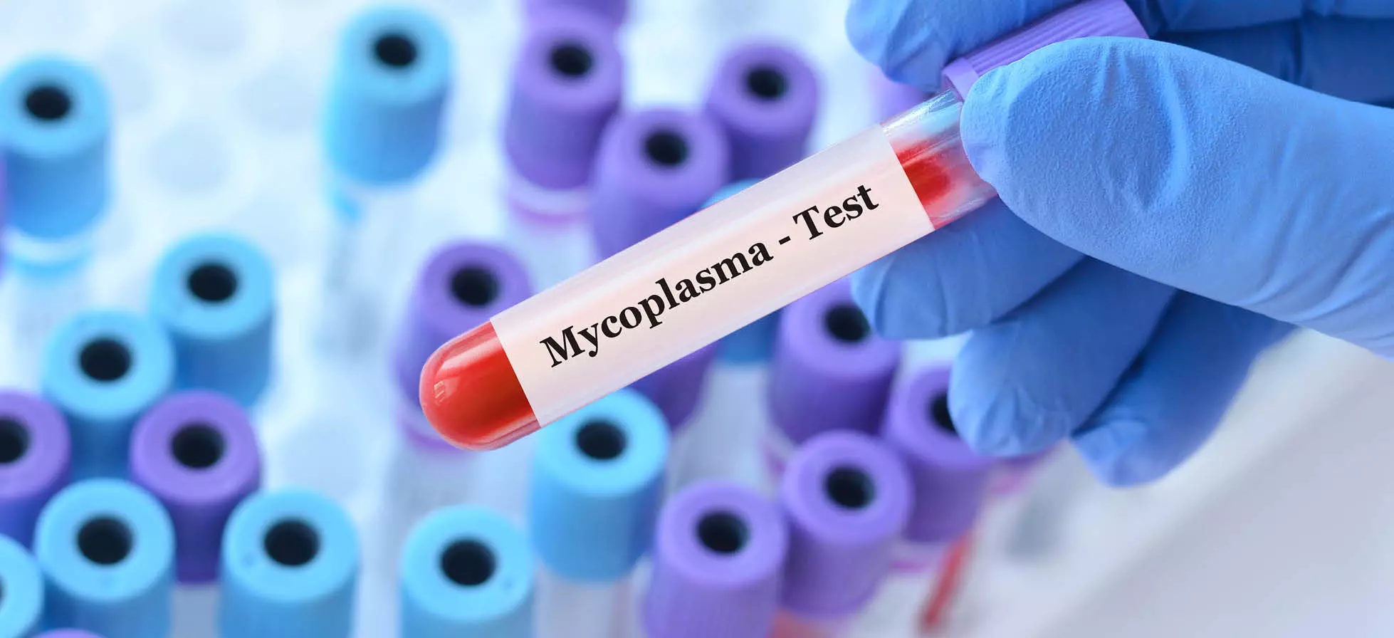 Mycoplasma: la bacteria que está generando alerta en nuestro país
