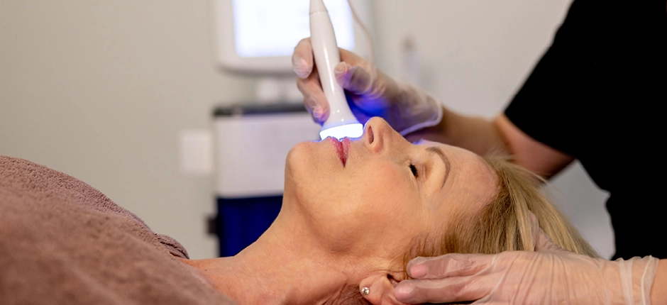 Rostro renovado: los tratamientos más elegidos en invierno