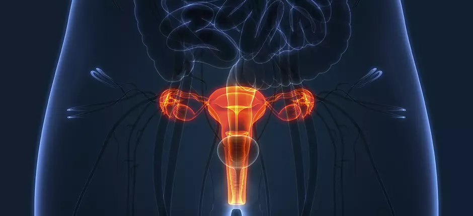 Virus papiloma humano y su relación con el cáncer cervicouterino