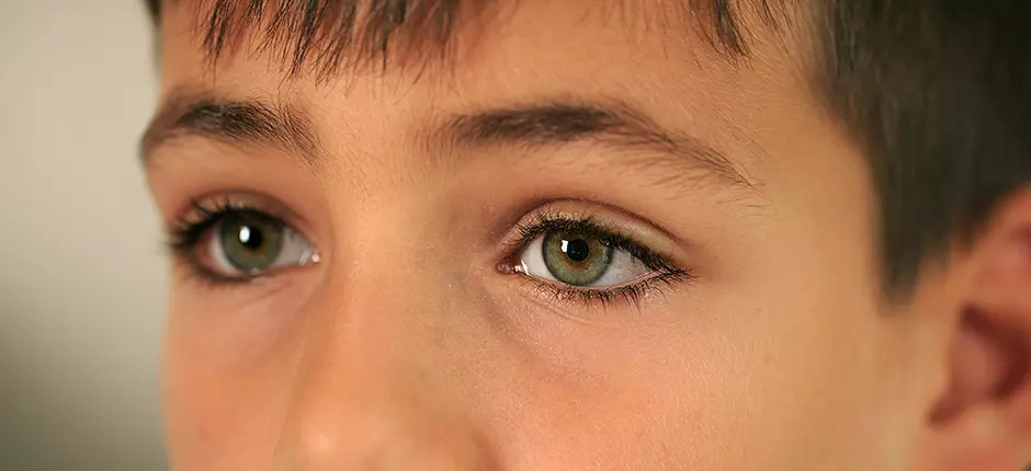 Verano: tiempo propicio para la conjuntivitis